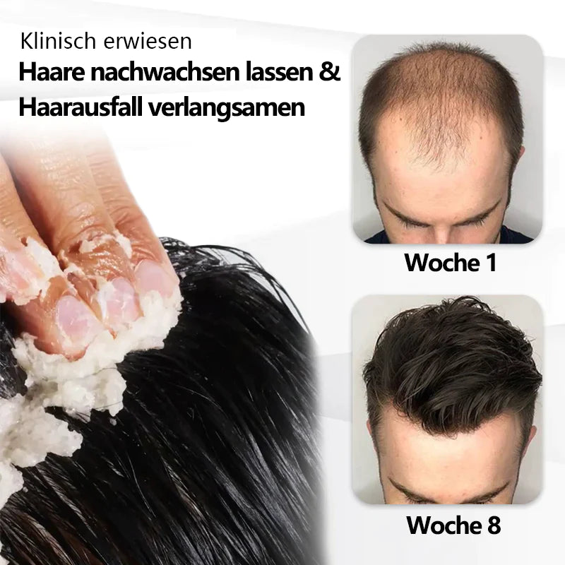Fivfivgo™ Prestige Strand Haarwachstum Scrub