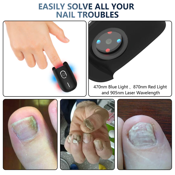Fivfivgo™ Dispositif laser antifongique