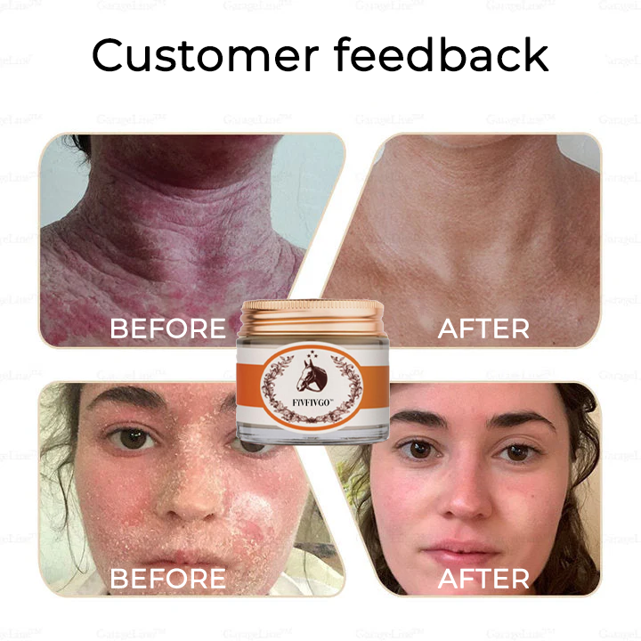 Fivfivgo™ Therapeutische Ölcreme für Pferde