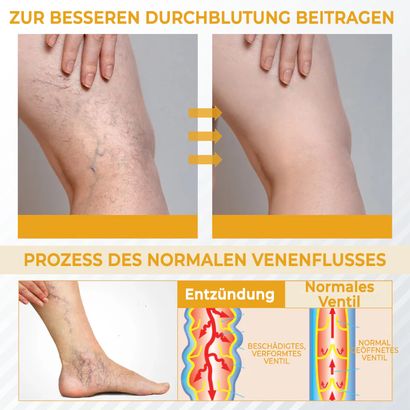 Fivfivgo® Bromelain Ödeme und Venen lindernde Creme