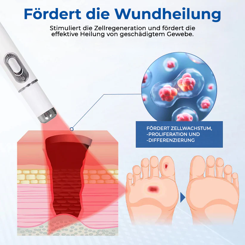 Bikenda® Lasertherapie Diabetische Wunde Kolirin Pen 💥 Heilt diabetische Wunden sofort
