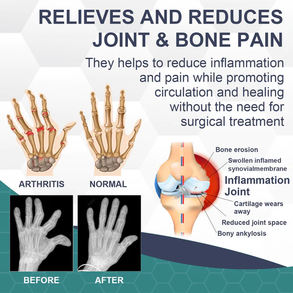 Fivfivgo™ Bee Venom Bunion Relief Cream