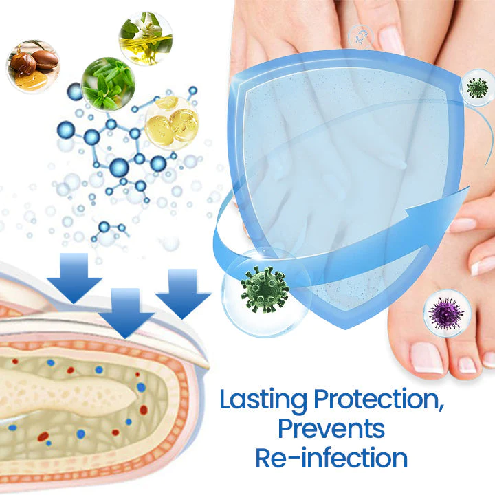 Fivfivgo™ NailHeal Gel réparateur d'ongles à base de plantes