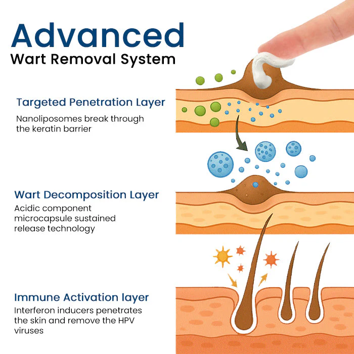 Fivfivgo® Herbal Genital Skin Treatment Cream ✅ Revolutionary Natural Solution for Genital Wart Treatment!