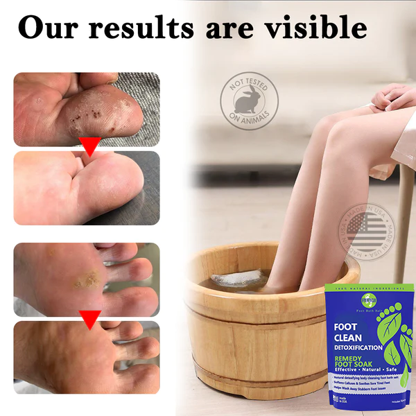 Fivfivgo™ Herbal Detoxifying puhdistava jalkahoitopakkaus