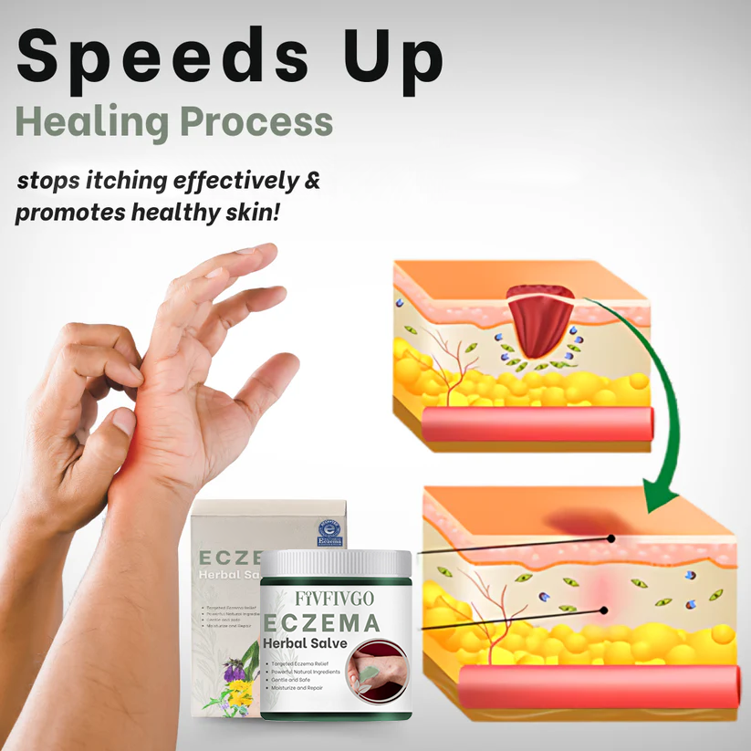 Fivfivgo™ Eczema Herbal Salve