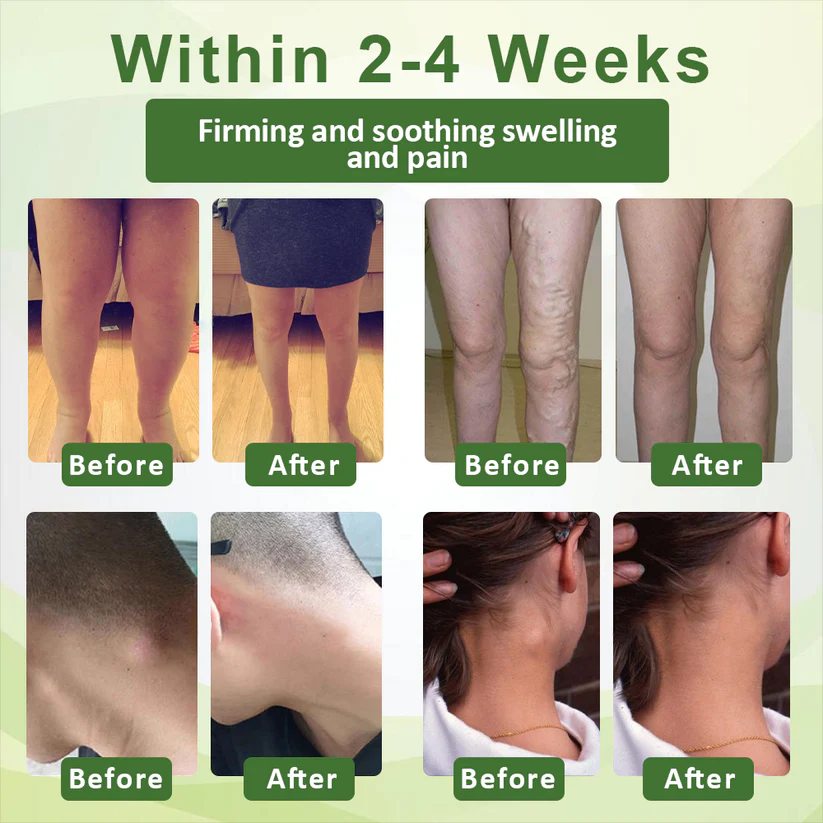 Fivfivgo™ SwellSoothe Lymphatische Creme