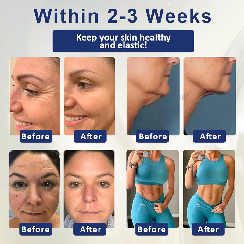 Fivfivgo™ Deep Elastic SkinRenew HA Cream