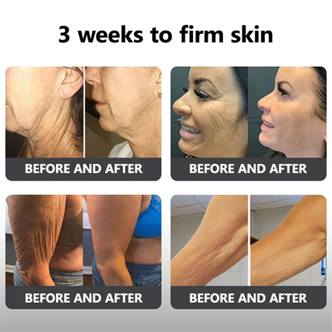 Fivfivgo™ Flüssiges Peptid-Peeling-Essenz