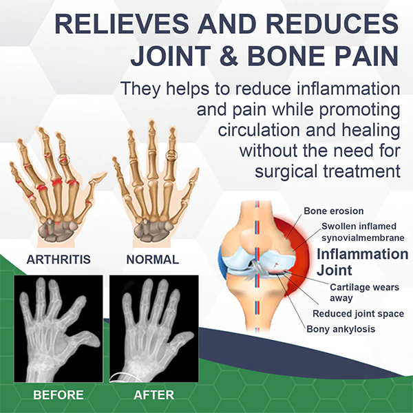 Fivfivgo™ PRO Bee Venom Pain and Bone Healing Cream