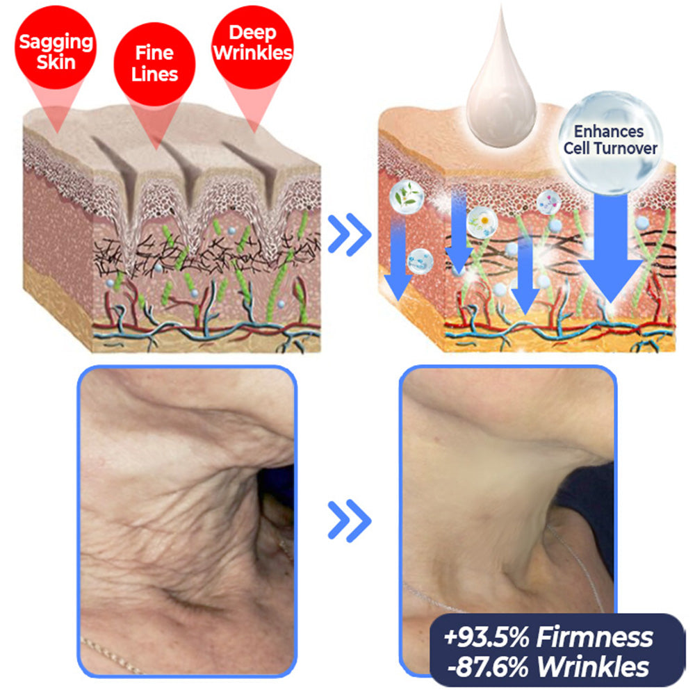 Fivfivgo™ Advanced Tightening & Wrinkles Reducing Lotion