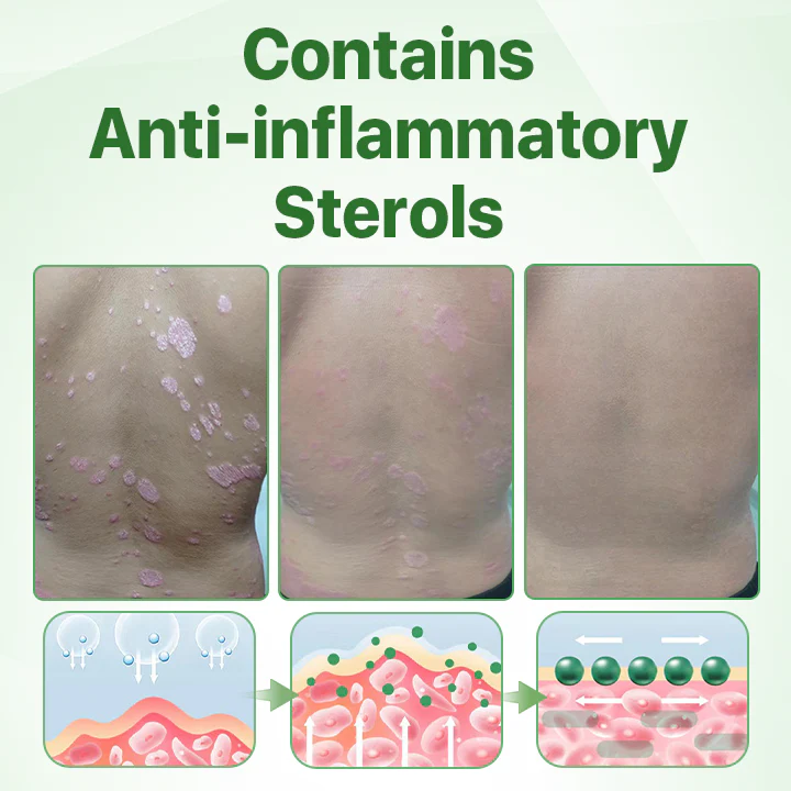 Fivfivgo™ Psoriasis Relief Crocodile Oil Soap