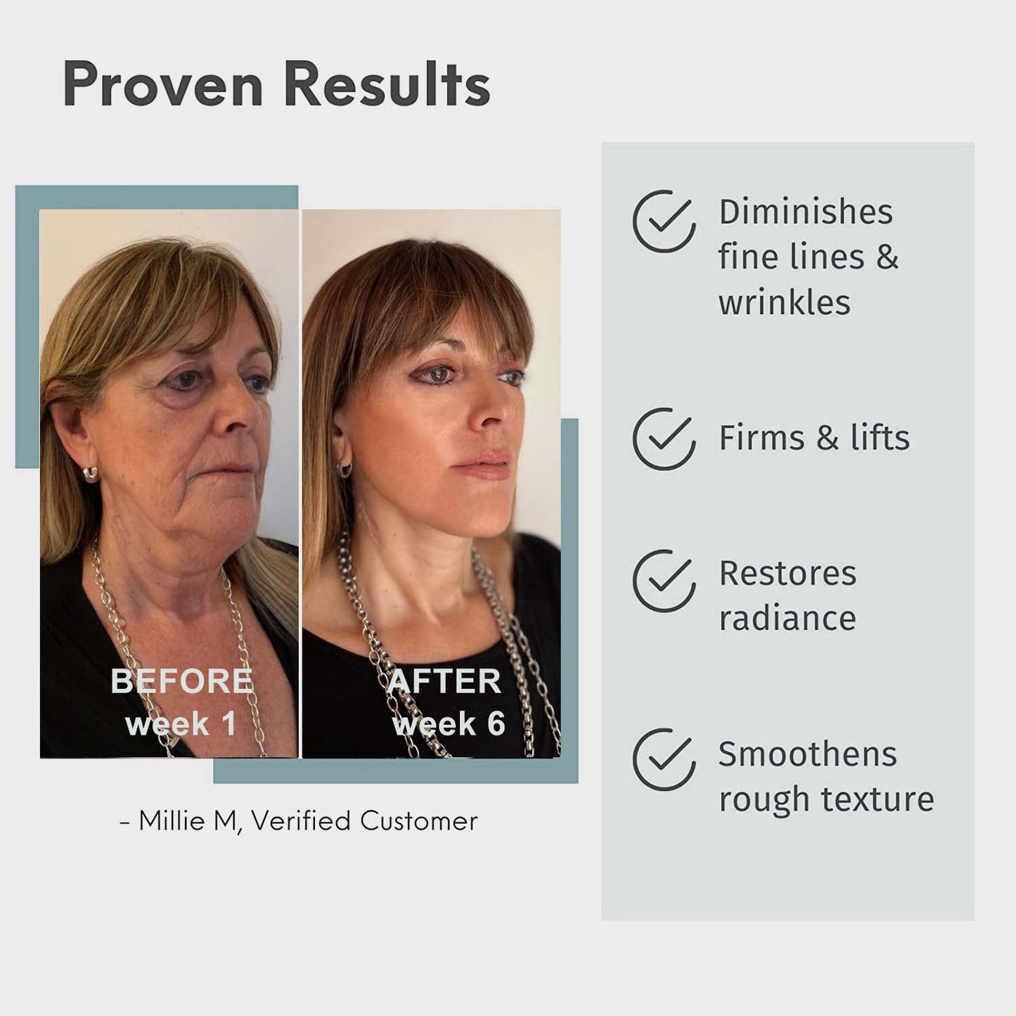 Fivfivgo™ 30 Tage Advanced Kollagen Boosten Anti-Ageing Botox Gesichtsserum