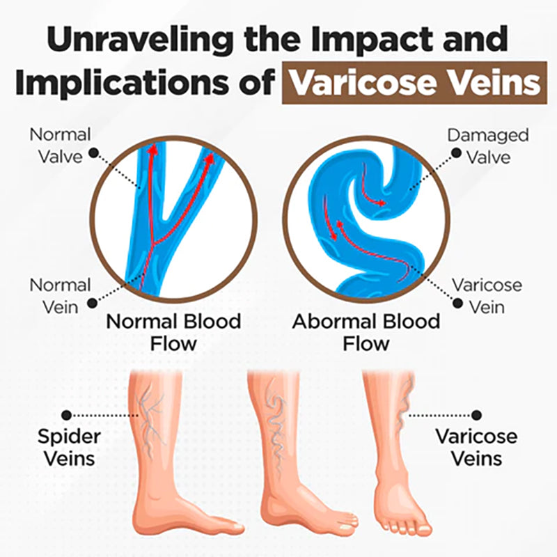 Fivfivgo™ Bee Venom Varicose Vein Cream