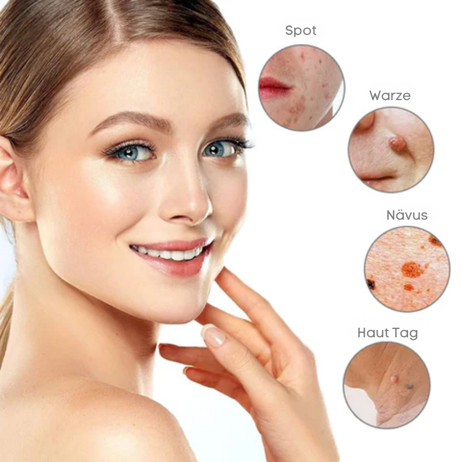 Fivfivgo™ Tragbarer Laser-Spot-Reinigungsstift
