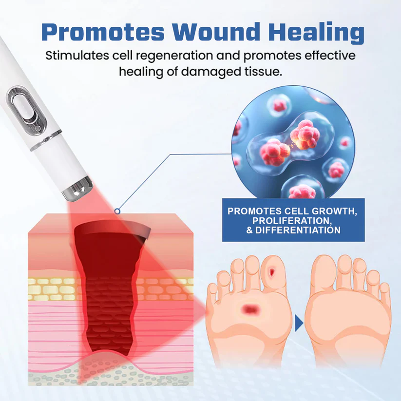 Bikenda® Laser Therapy Diabetic Wound Kolirin Pen 💥 Heals Diabetic Wounds Instanly