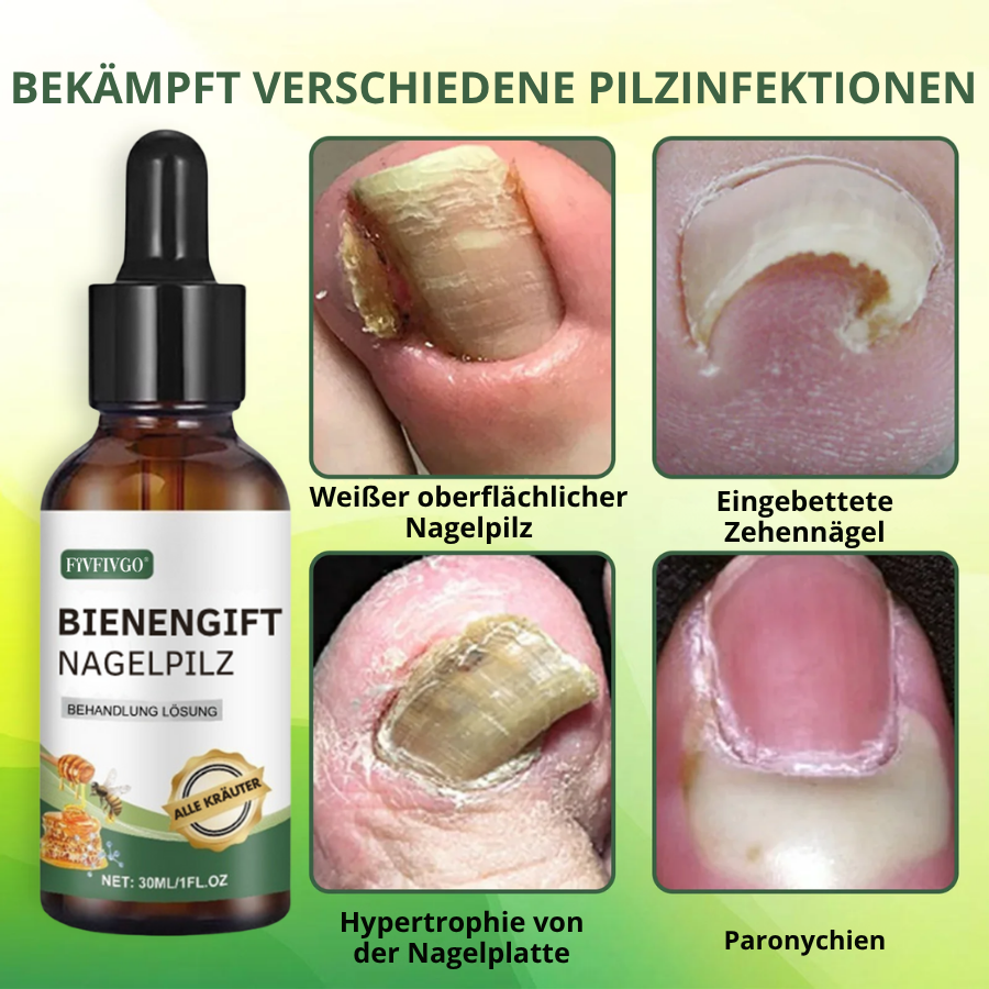 Fivfivgo® Bienengift Nagelpilz Behandlung Lösung: Natürliche Formel für die Gesundheit von Zehennägeln und Fingernägeln