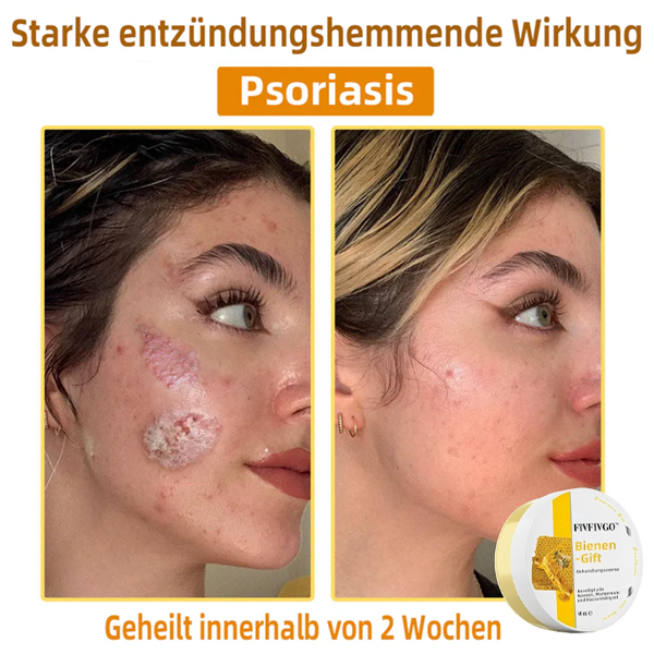 Fivfivgo™ Bienengift-Therapie-Creme
