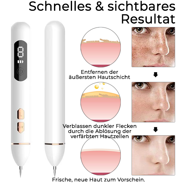 Fivfivgo™ Laser-Punkt-Entfernungsstift
