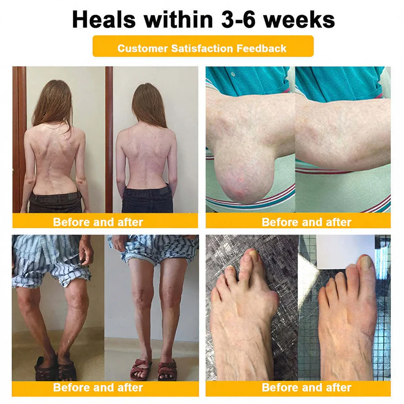 NovaRX®  Bee Venom Pain-Relief Joint Soothing Spray