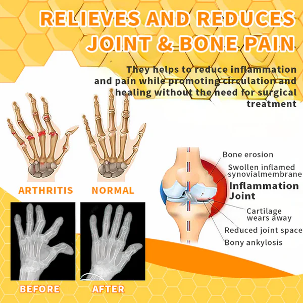 Fivfivgo™ Honey Bee Venom Joint Therapy Pain Relief Gel