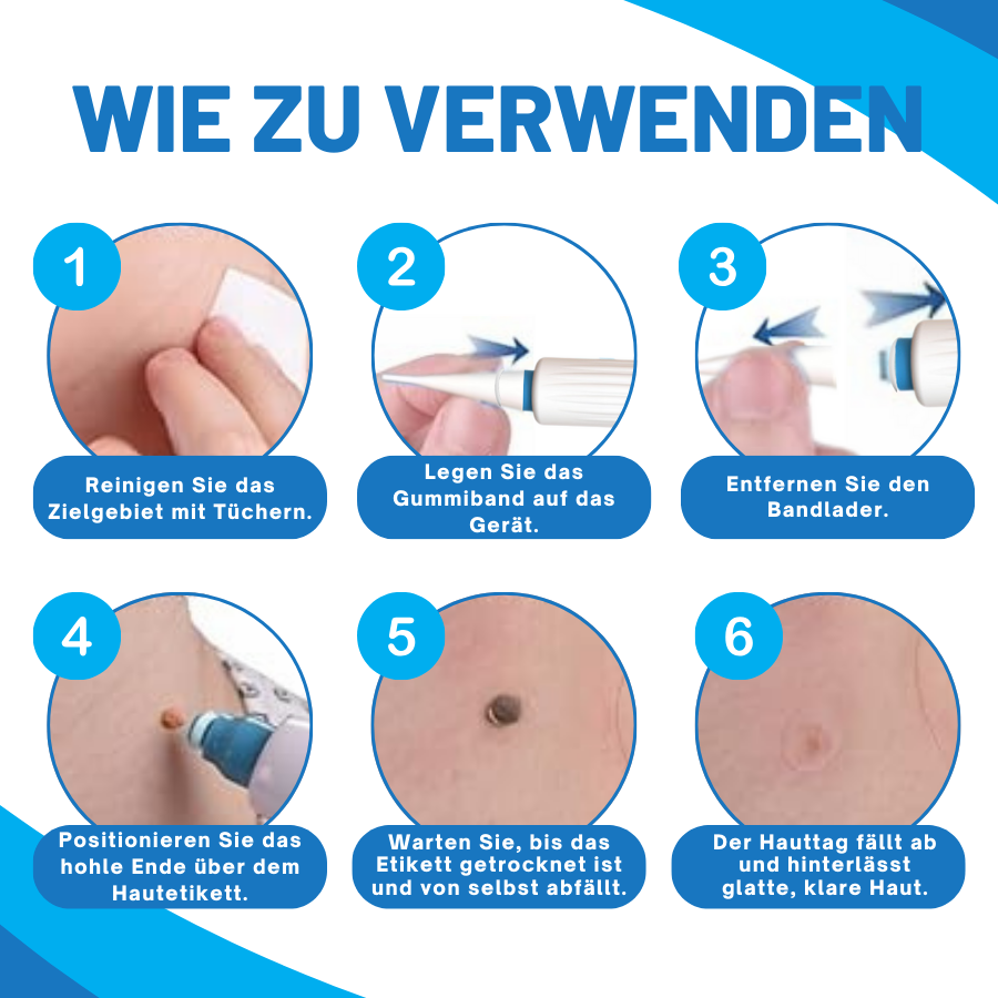 Fivfivgo™ Zu Hause Haut Tag Einfädeln Stift