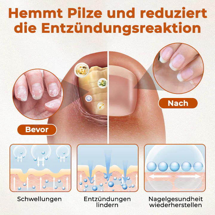 Fivfivgo® BeeShield Pilzlinderungstropfen