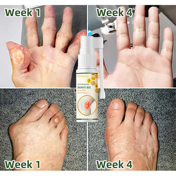 Fivfivgo™ Bee Venom Pain and Bone Healing Spray