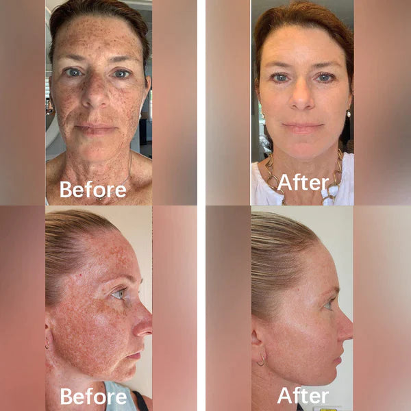 Fivfivgo™ Wrinkle Free & Flawless Serum
