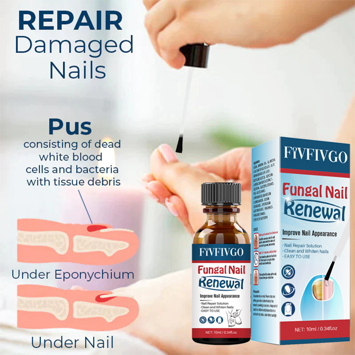 Fivfivgo™ Nail Fungus Treatment Gel