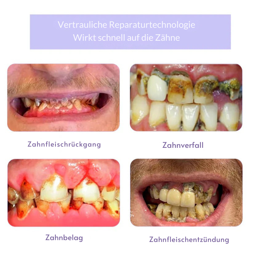 Fivfivgo™ Zahnrestauration Mineralisches Puder