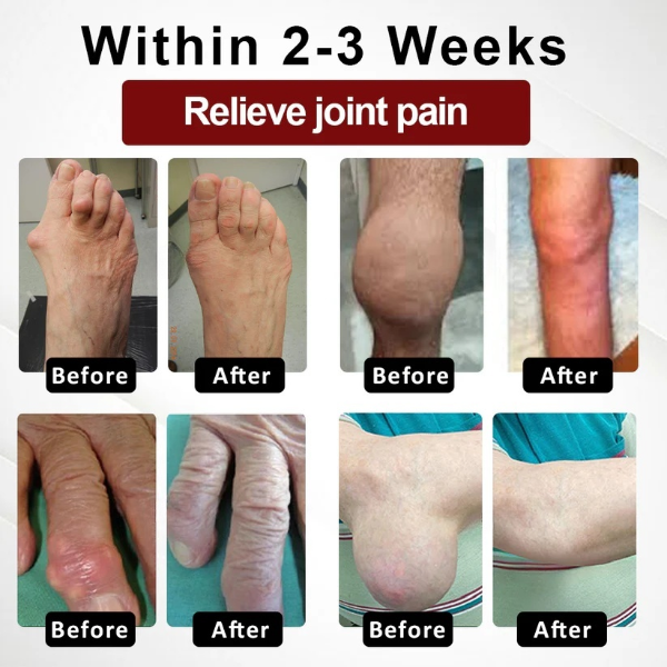 Fivfivgo™ Rosskastanie Arthritis-Massagecreme