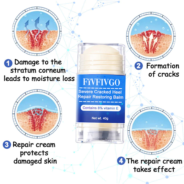 Fivfivgo™ Intense Cracked Heel Repair Cream