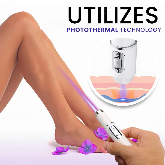 Fivfivgo® Varicose Vein Photothermal Laser Treatment