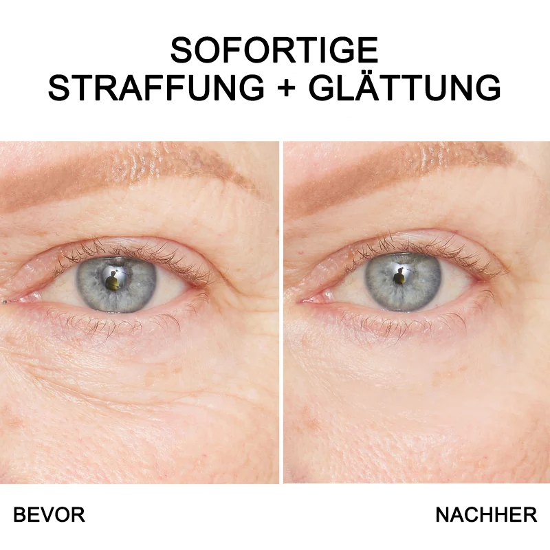 Fivfivgo™ Creme zur sofortigen Straffung der Augenfalten