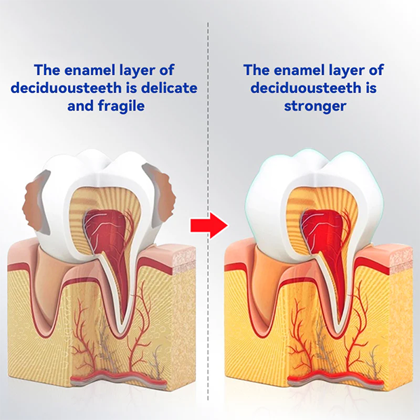 Fivfivgo™ Dentifrice anti-carie pour la santé des gencives