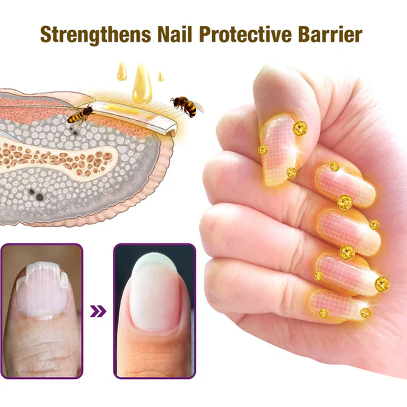 Fivfivgo™ Bienengift Nagelbehandlung Serum