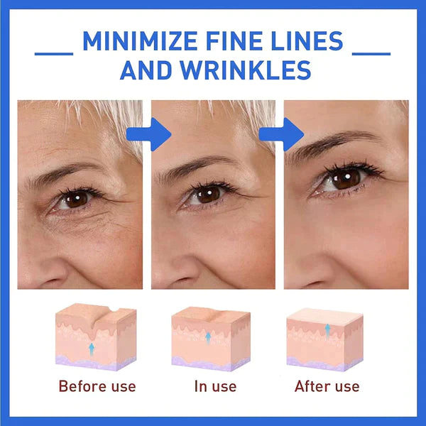 Fivfivgo™ Organische Retinol-Creme
