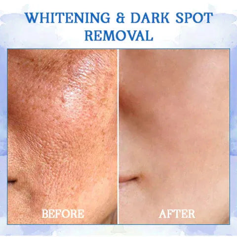 Fivfivgo™ Ultra Firming & Revitalizing Cream (Renew Skin Firmness)