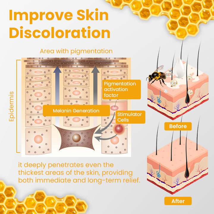 Fivfivgo™ Vitiligo Rescue Bienengift Pflegecreme