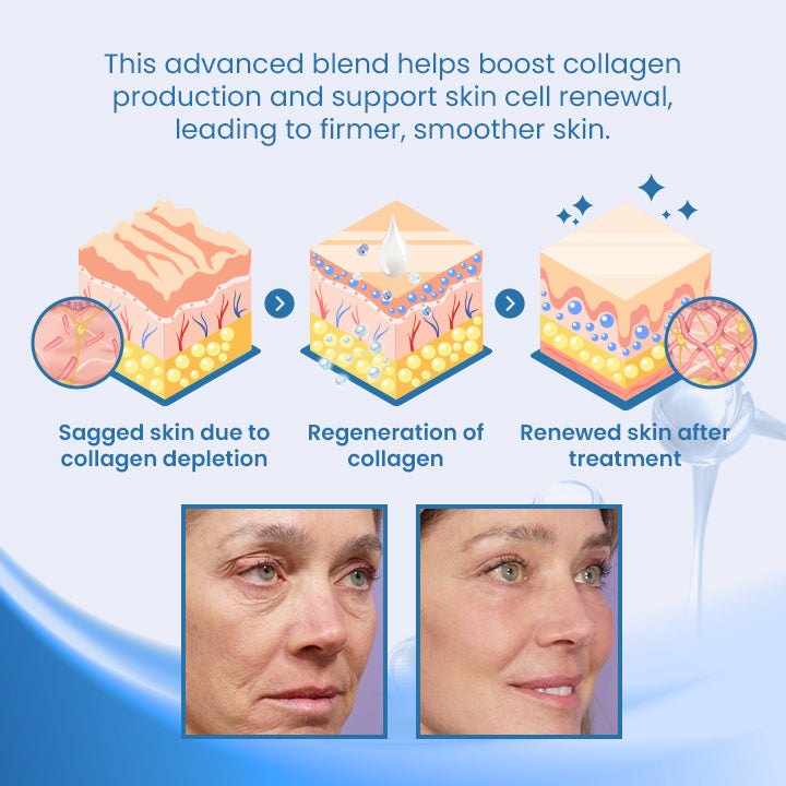 Fivfivgo® BotoxPLUS Retinol Eye Cream - Dermatologist Recommended (Eye Cream for Fine Lines, Wrinkles, Dark Circles, Dark Spots, and Daily Anti-Aging)