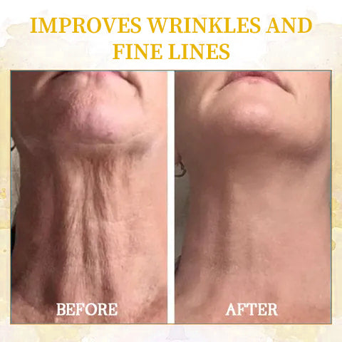 Fivfivgo™ Skin-Firming Tightening Body Serum