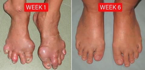 Fivfivgo™ Bee Venom Advanced Joint and Bone Therapy Cream (New Zealand Bee Extract - Specializes in Orthopedic Diseases and Arthritis Pain)