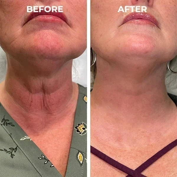 Fivfivgo™ Botox Facial Serum