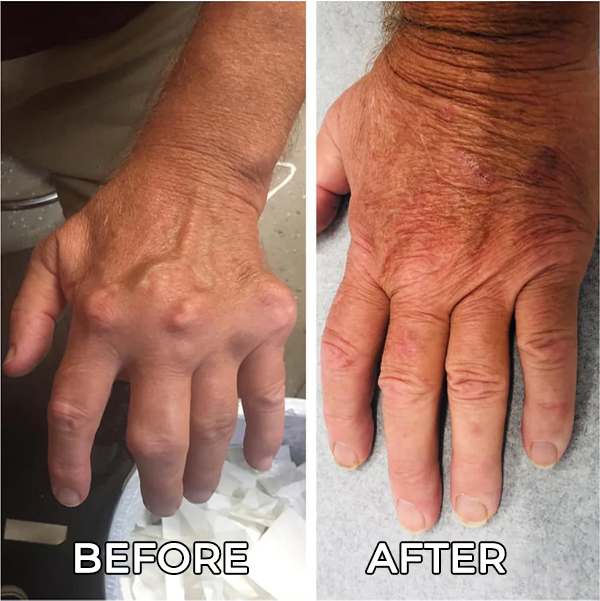 Fivfivgo™ Chondroitin Ointment for Arthritis