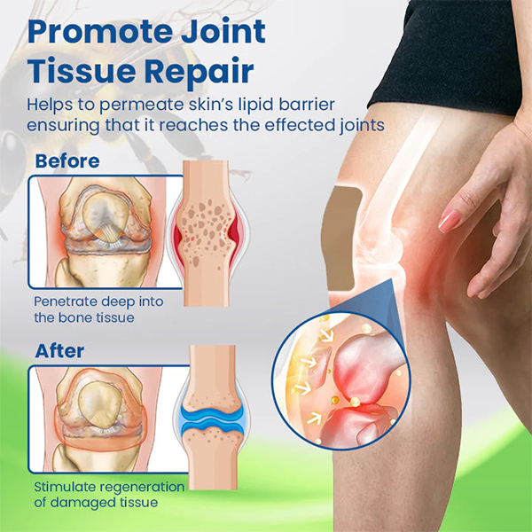 Fivfivgo™ Joint & Bone BeeNom Therapy Patch