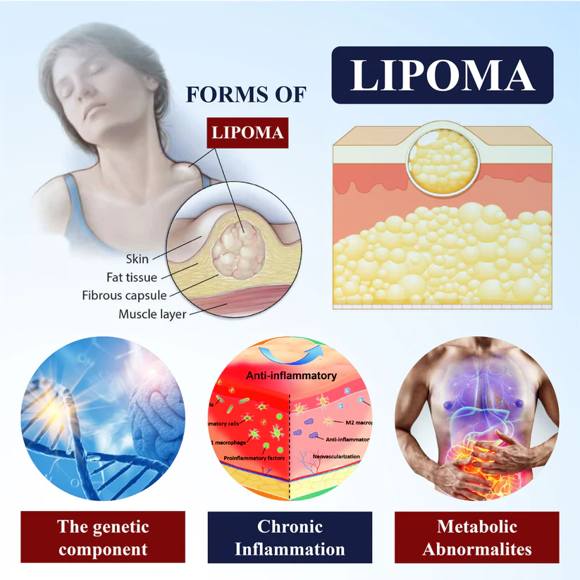 Fivfivgo®  LipoEase Herbal Matrix-4 Cream