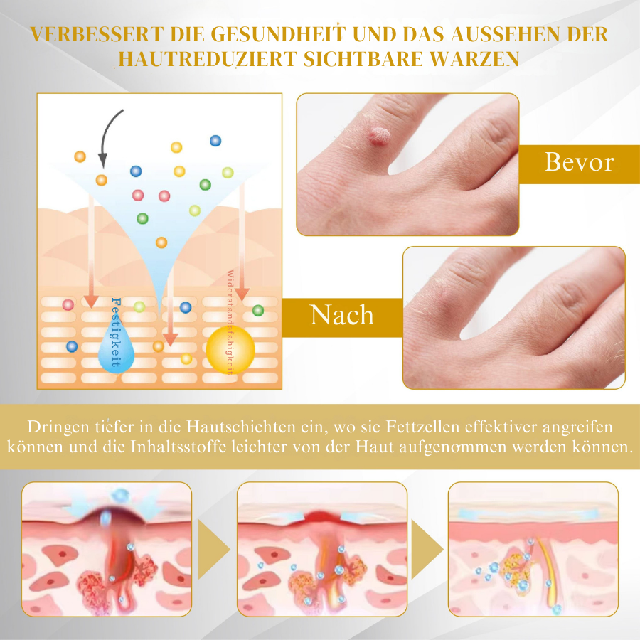 Fivfivgo® Fortschrittliches Maulwurf & Fleck Korrigierendes Bienengel