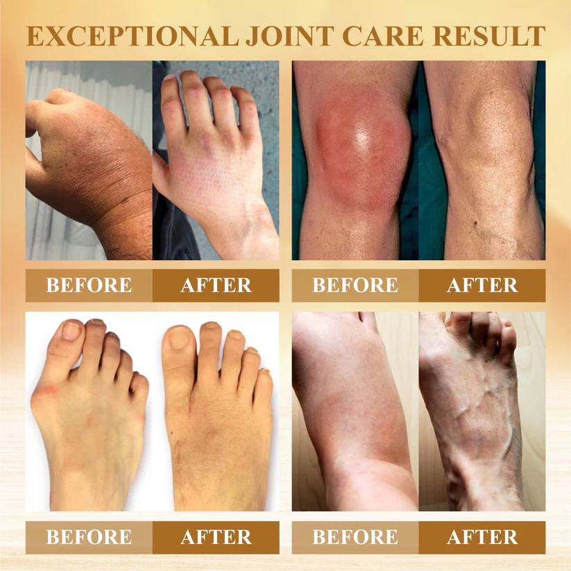Fivfivgo™ Joint Soothe Mellifera Venom Bar