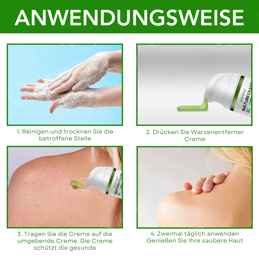 ✅ Offizieller Laden: Fivfivgo™ NatureErase Sofortige Maulwurf- und Fleckencreme
